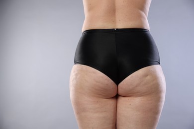 Photo of Woman with cellulite on light grey background, closeup. Space for text