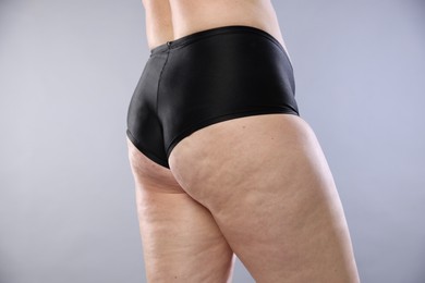 Photo of Woman with cellulite on light grey background, closeup