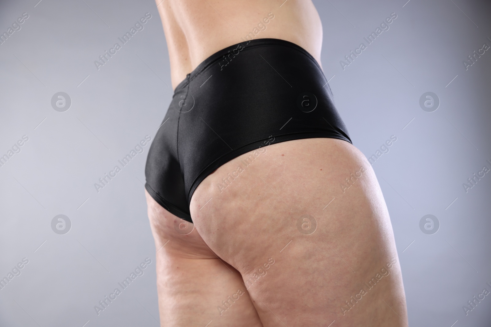 Photo of Woman with cellulite on light grey background, closeup