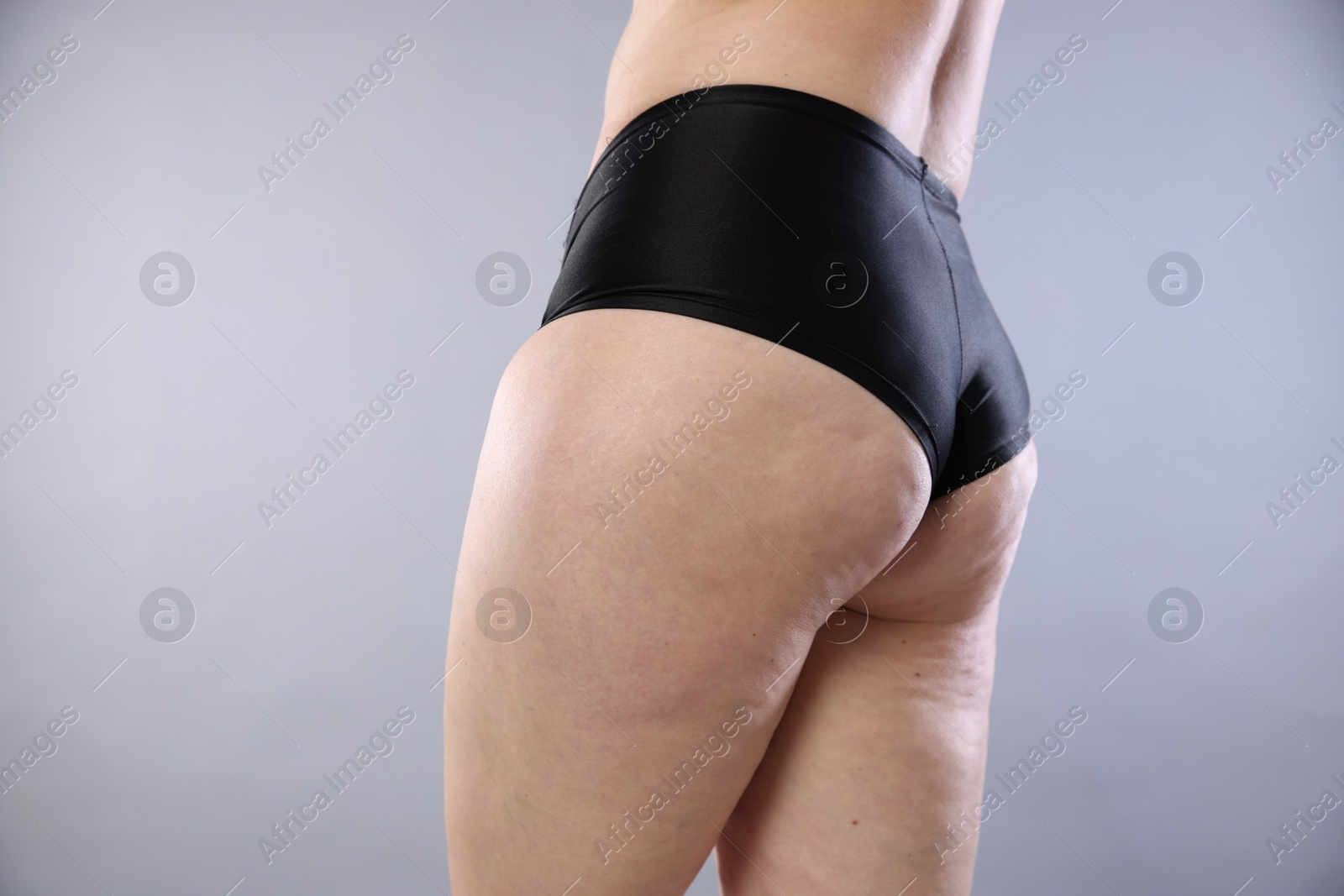 Photo of Woman with cellulite on light grey background, closeup