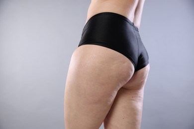 Photo of Woman with cellulite on light grey background, closeup