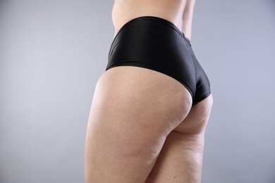 Photo of Woman with cellulite on light grey background, closeup