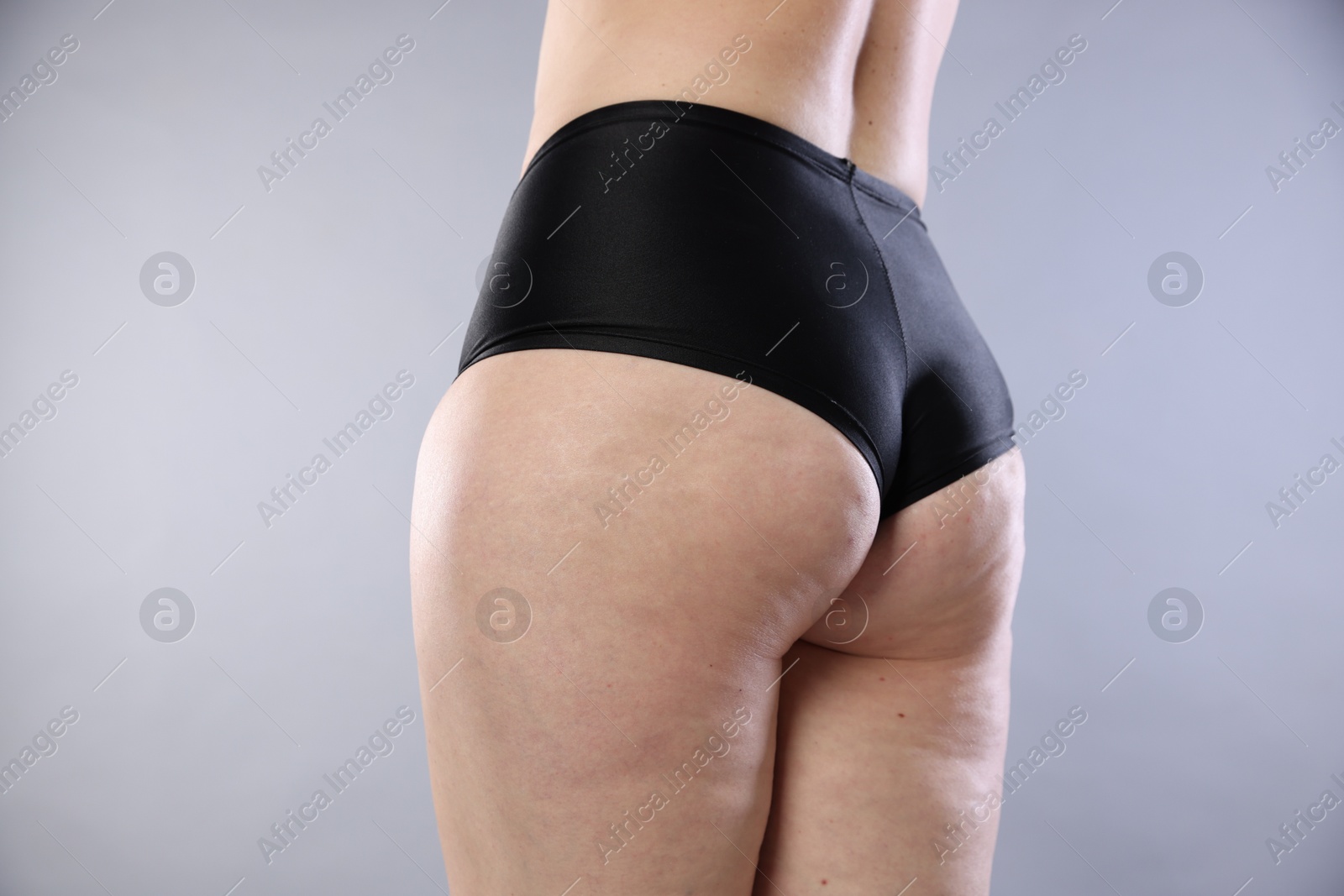 Photo of Woman with cellulite on light grey background, closeup