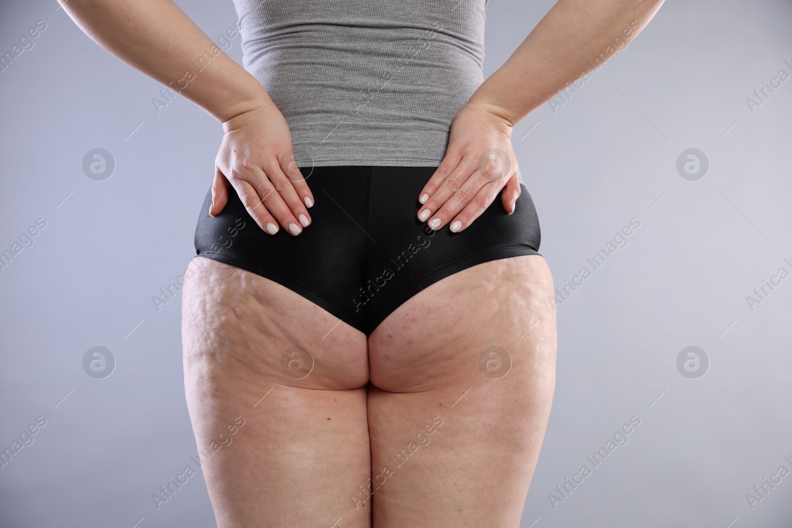 Photo of Woman with cellulite on light grey background, closeup