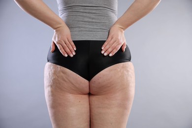 Photo of Woman with cellulite on light grey background, closeup