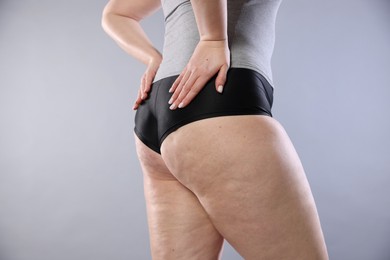 Photo of Woman with cellulite on light grey background, closeup