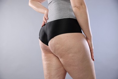 Photo of Woman with cellulite on light grey background, closeup