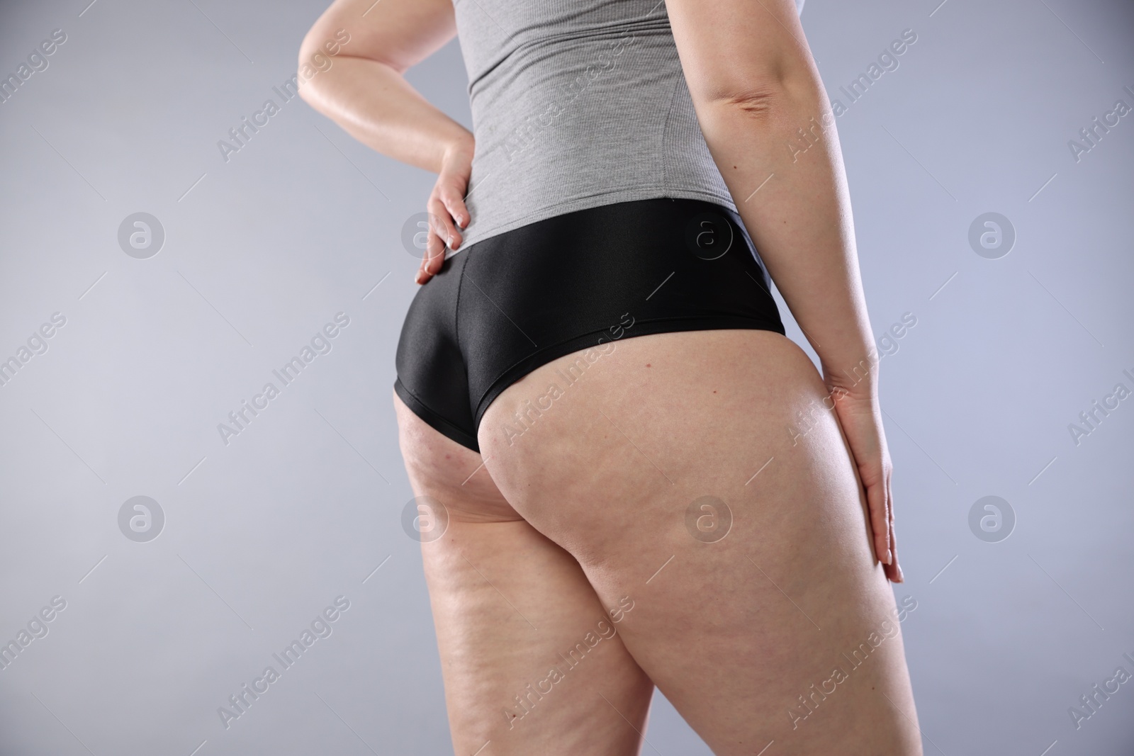 Photo of Woman with cellulite on light grey background, closeup