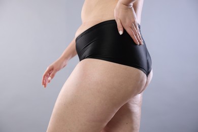 Photo of Woman with cellulite on light grey background, closeup