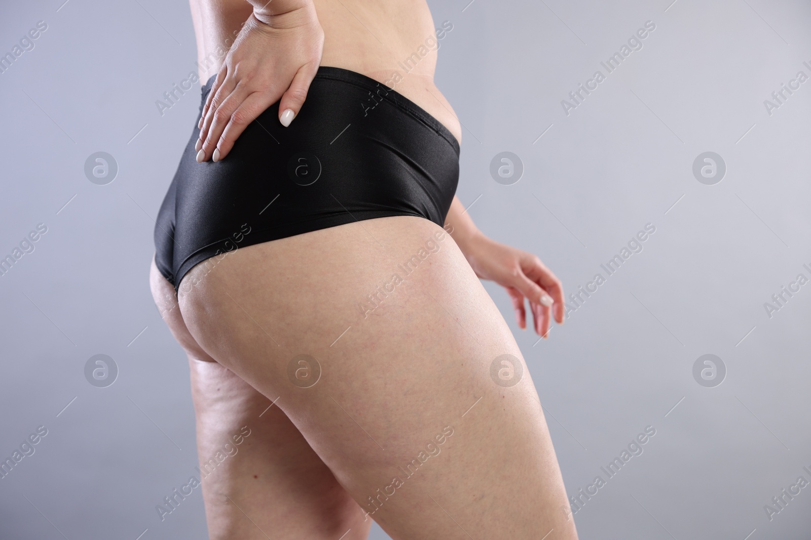 Photo of Woman with cellulite on light grey background, closeup. Space for text