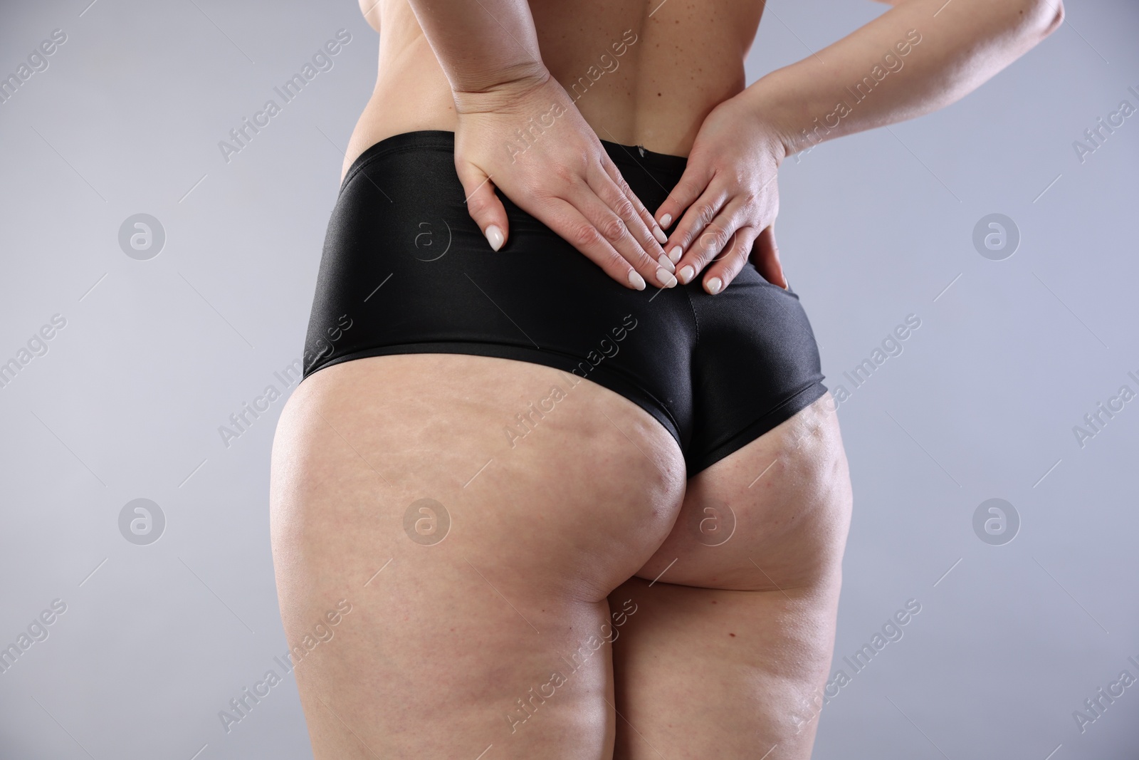 Photo of Woman with cellulite on light grey background, closeup