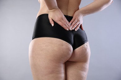 Photo of Woman with cellulite on light grey background, closeup