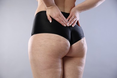 Photo of Woman with cellulite on light grey background, closeup