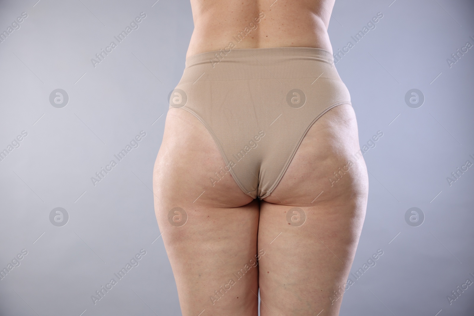 Photo of Woman with cellulite on light grey background, closeup