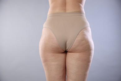 Photo of Woman with cellulite on light grey background, closeup