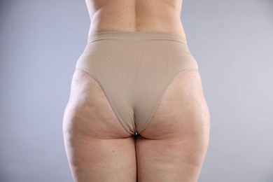 Photo of Woman with cellulite on light grey background, closeup