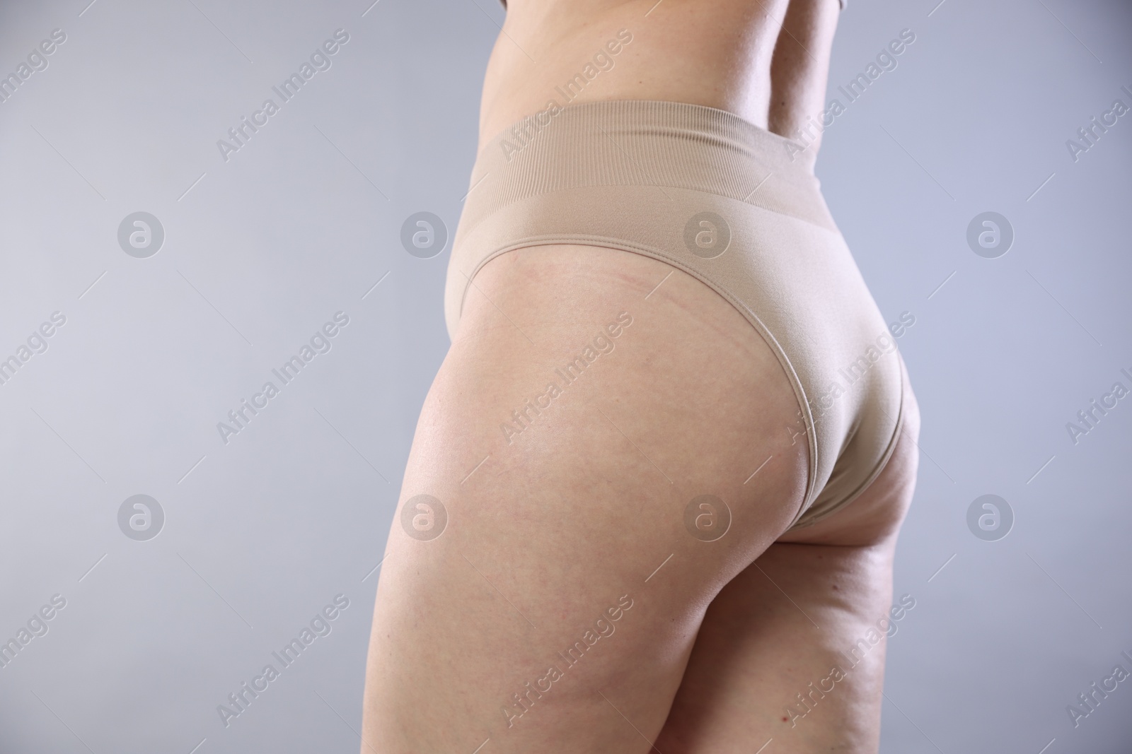 Photo of Woman with cellulite on light grey background, closeup. Space for text