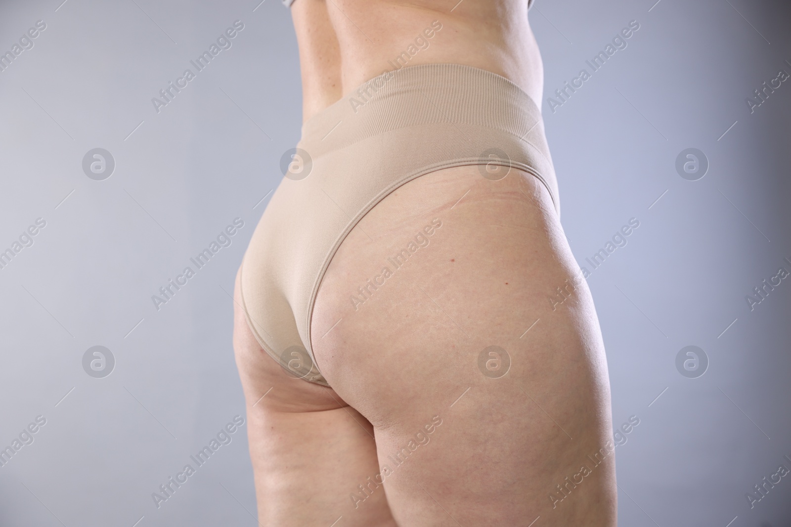 Photo of Woman with cellulite on light grey background, closeup