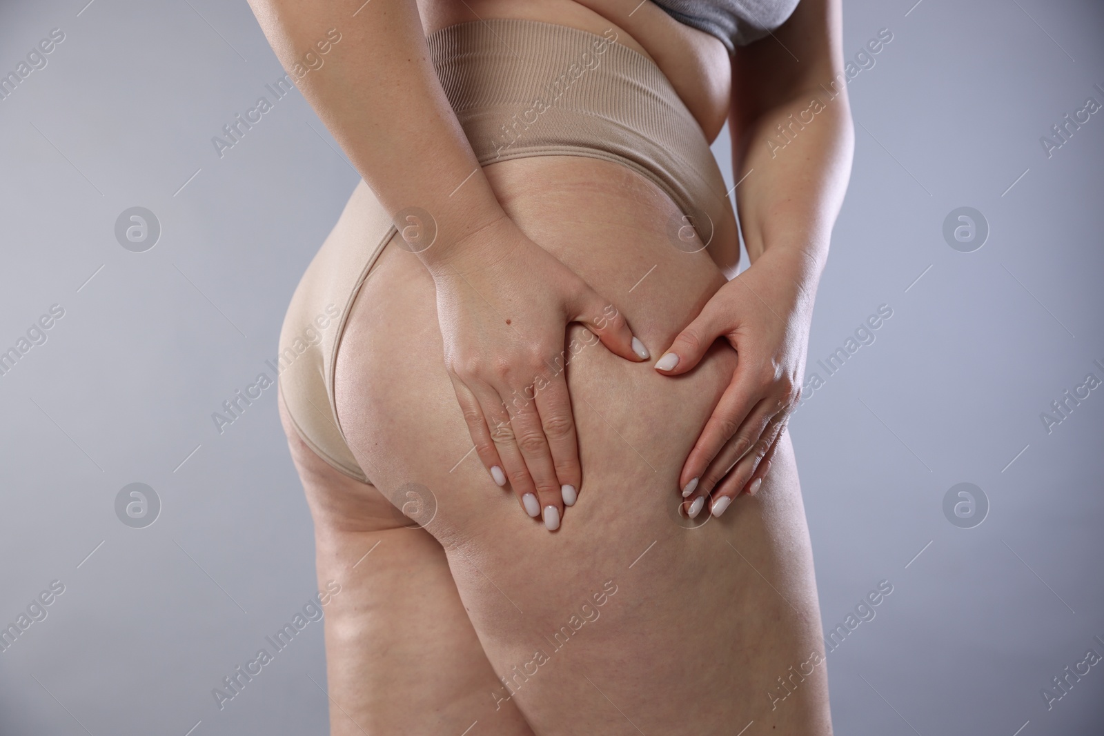 Photo of Woman with cellulite on light grey background, closeup