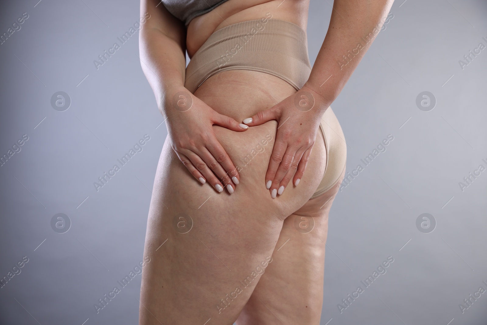 Photo of Woman with cellulite on light grey background, closeup