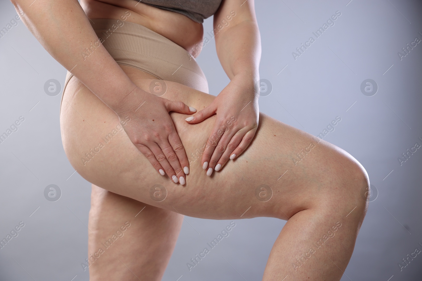 Photo of Woman with cellulite on light grey background, closeup