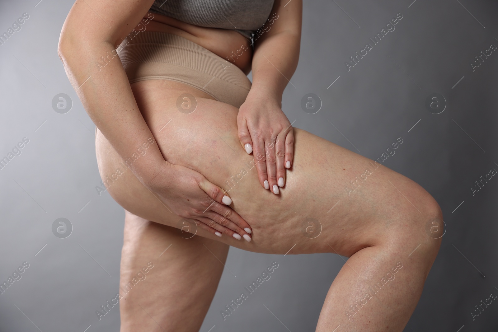 Photo of Woman with cellulite on grey background, closeup