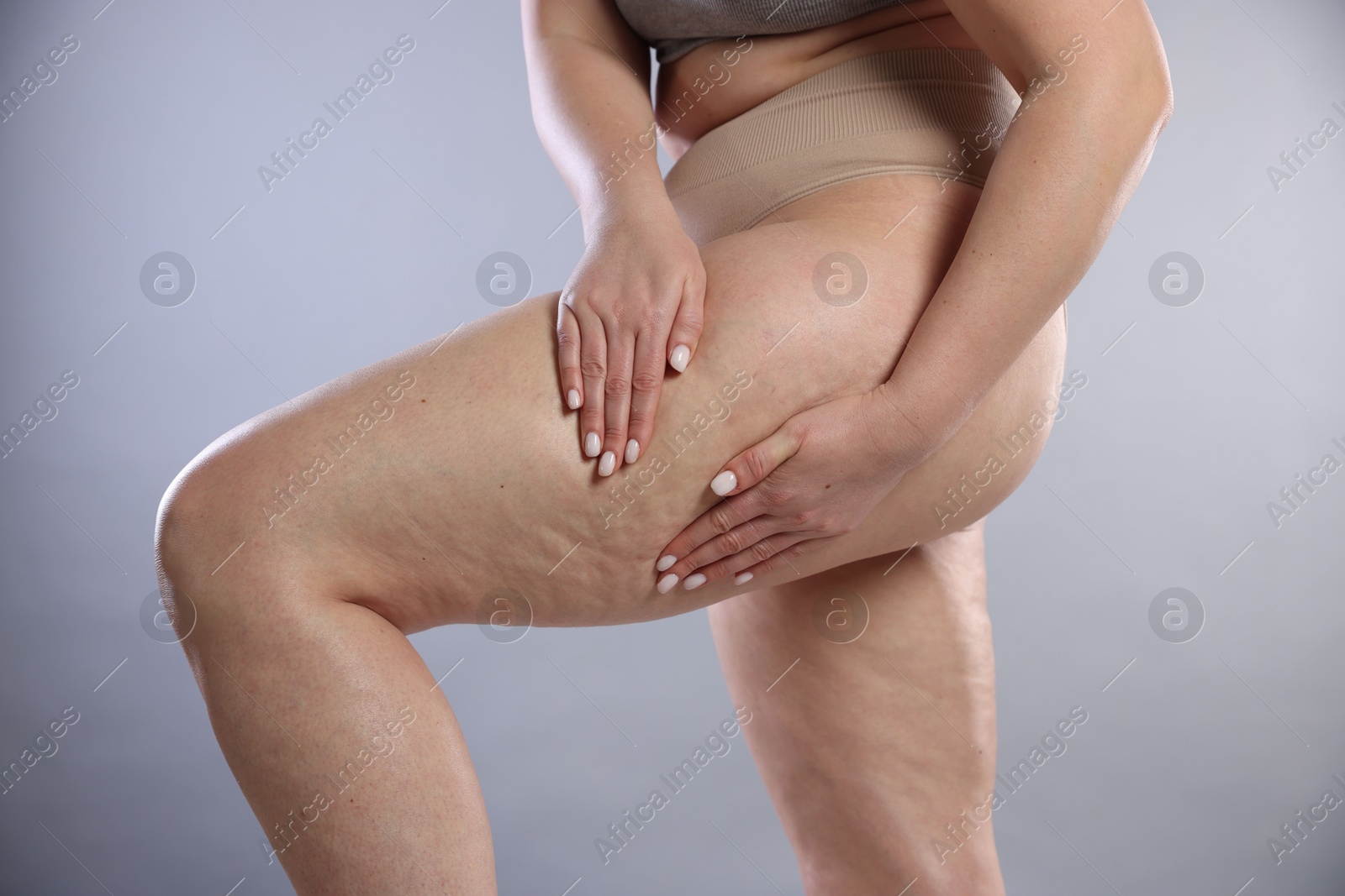 Photo of Woman with cellulite on light grey background, closeup