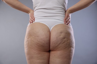 Photo of Woman with cellulite on light grey background, closeup