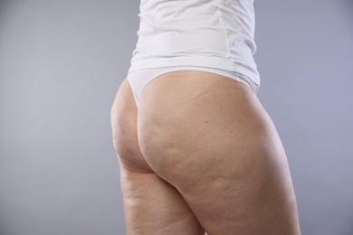 Photo of Woman with cellulite on light grey background, closeup