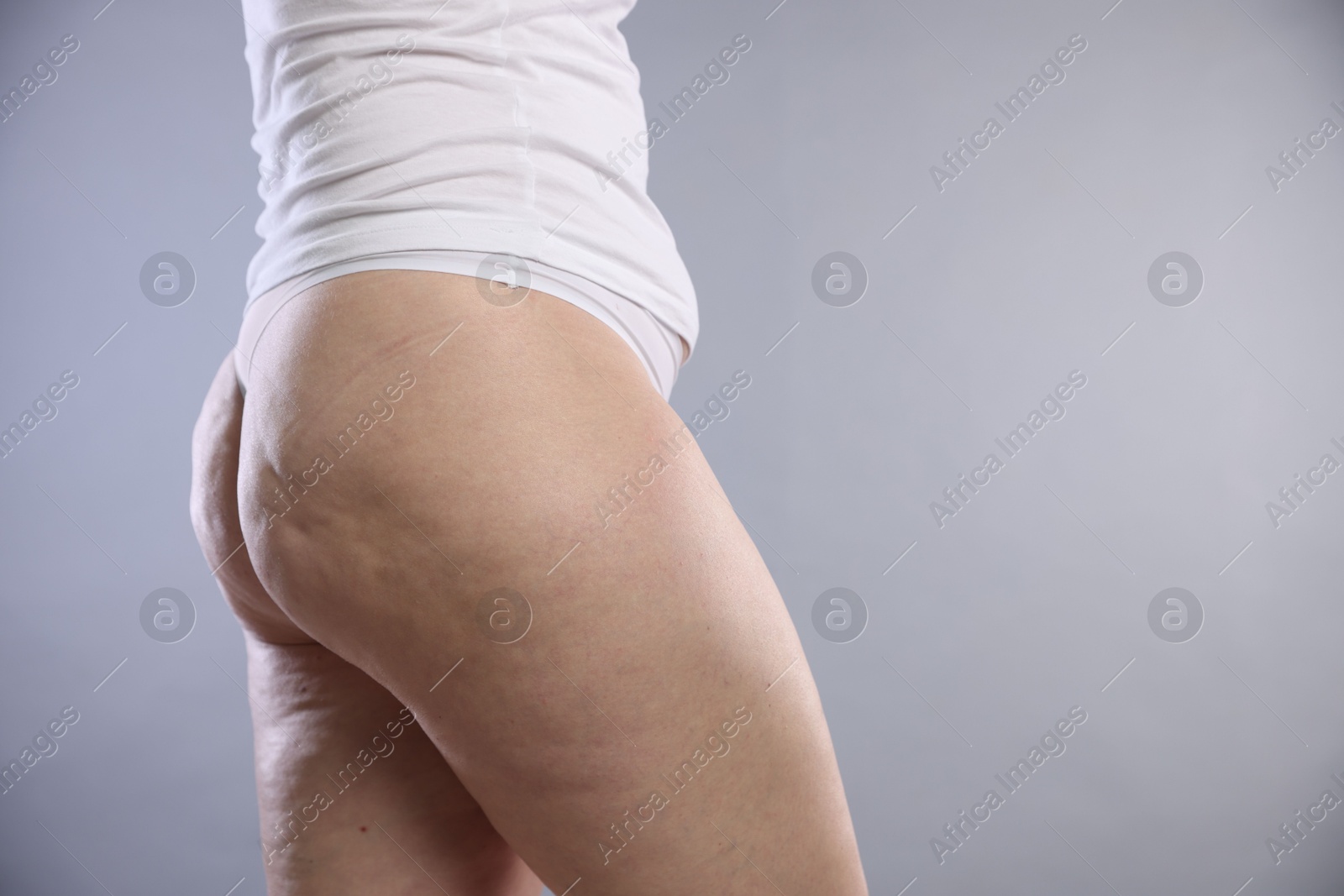 Photo of Woman with cellulite on light grey background, closeup. Space for text