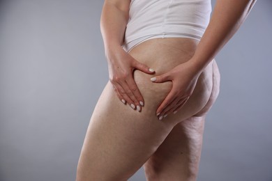 Photo of Woman with cellulite on light grey background, closeup