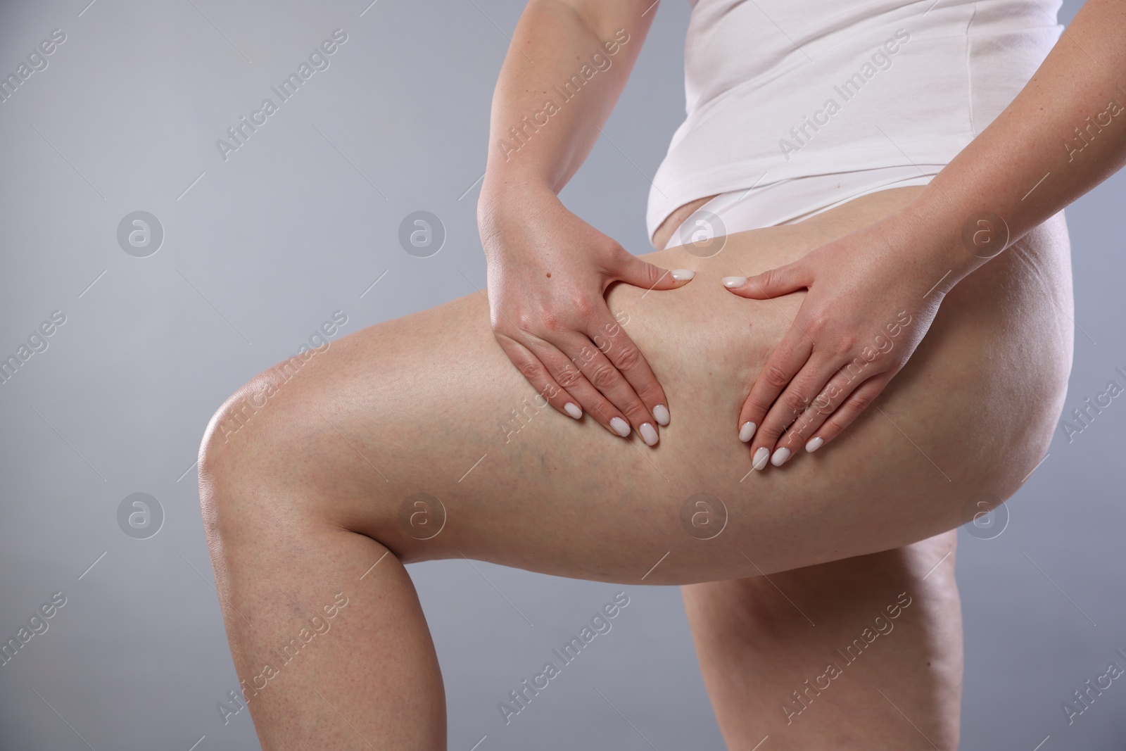 Photo of Woman with cellulite on light grey background, closeup