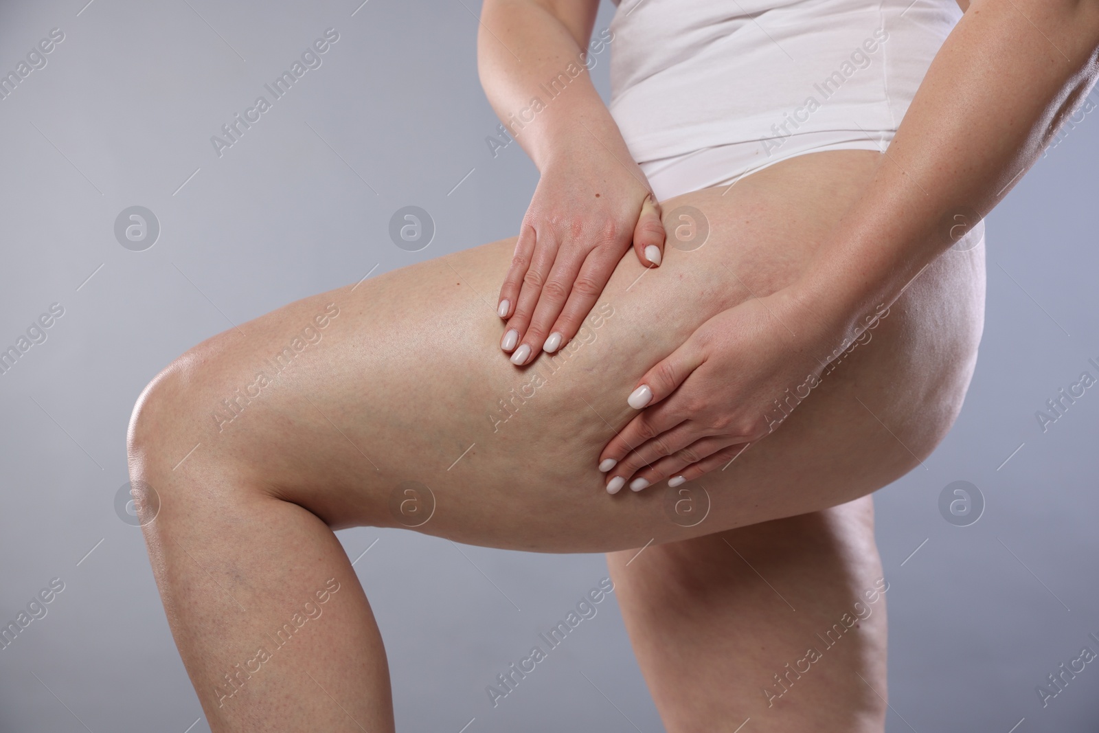 Photo of Woman with cellulite on light grey background, closeup