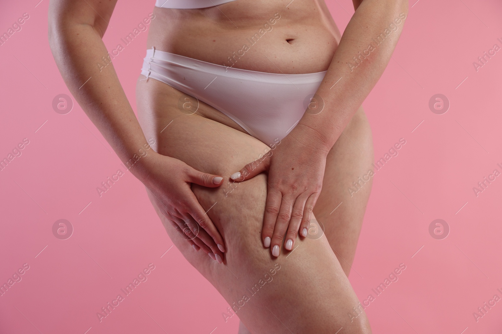 Photo of Woman with cellulite on pink background, closeup