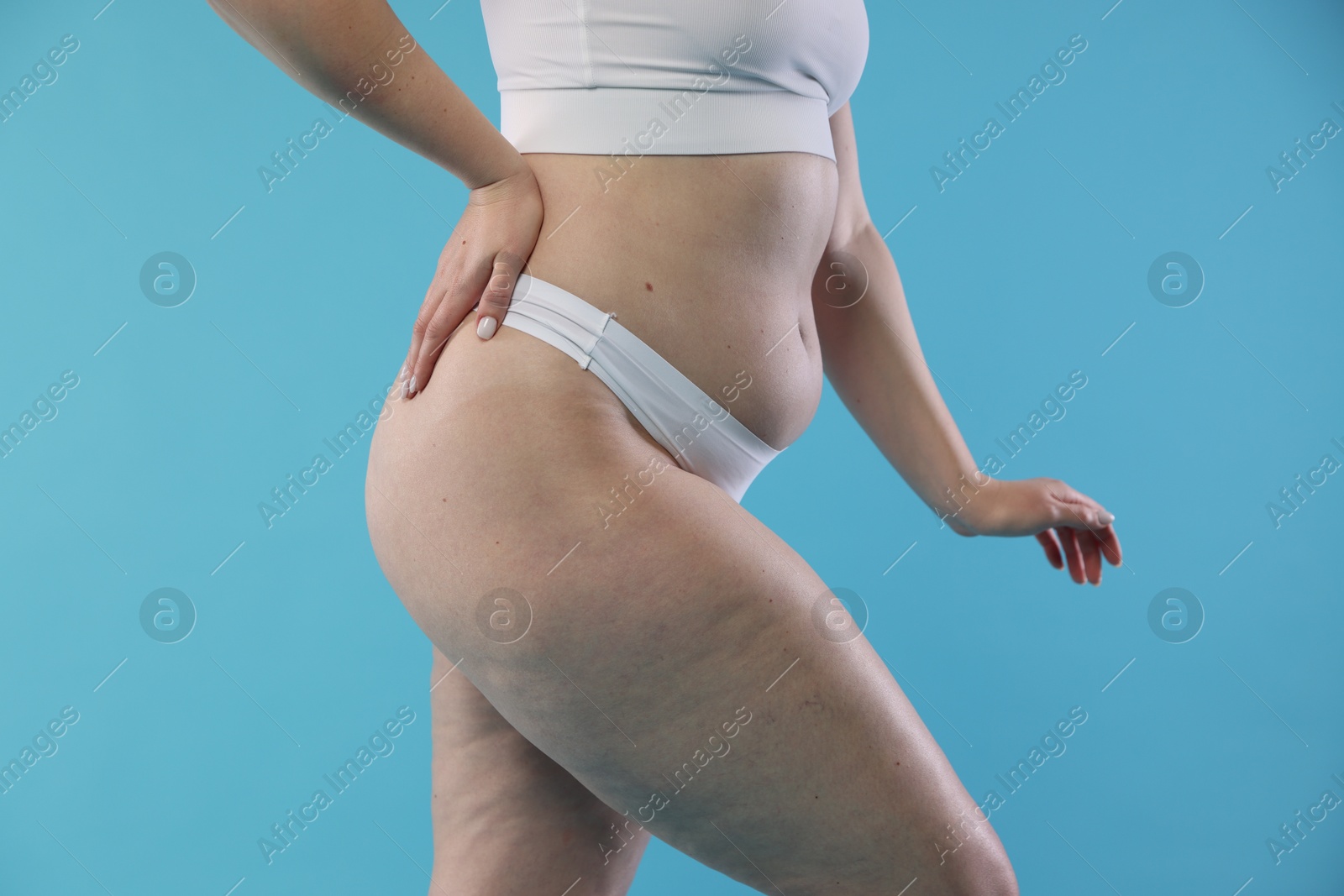 Photo of Woman with cellulite on light blue background, closeup