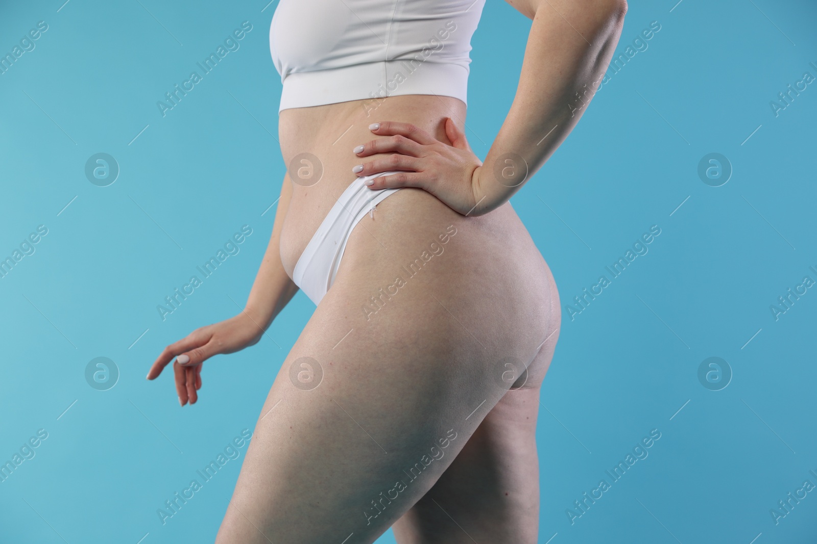 Photo of Woman with cellulite on light blue background, closeup