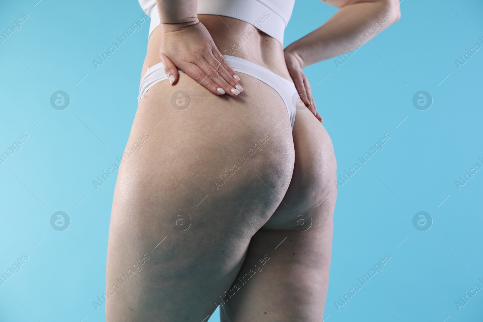 Photo of Woman with cellulite on light blue background, closeup