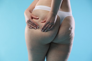 Photo of Woman with cellulite on light blue background, closeup