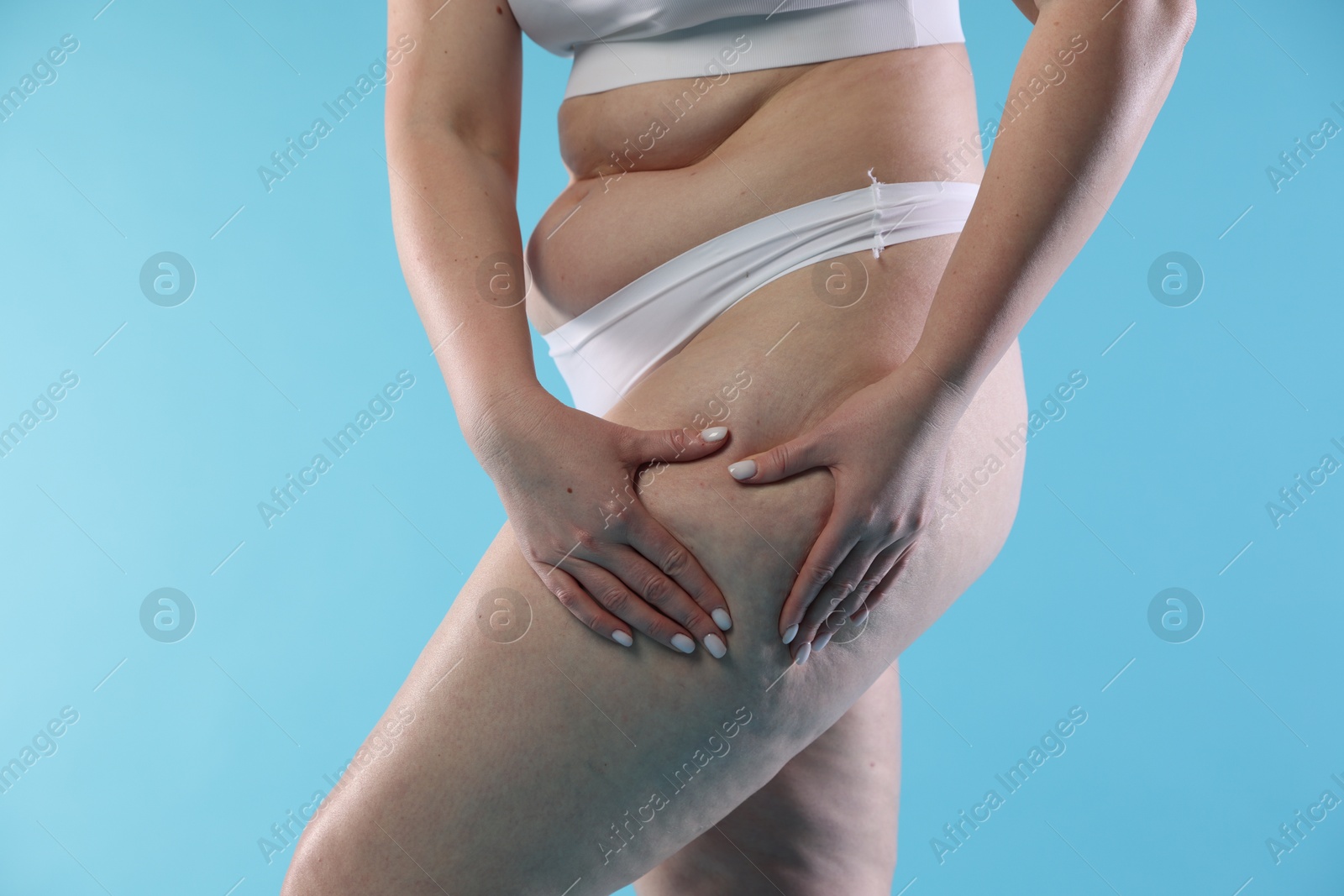 Photo of Woman with cellulite on light blue background, closeup