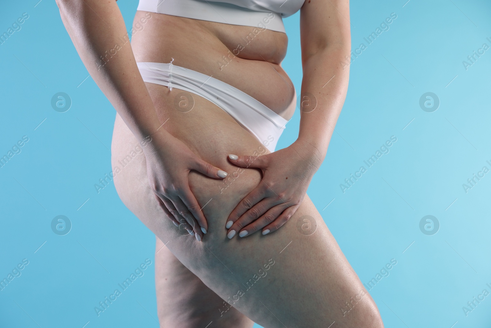 Photo of Woman with cellulite on light blue background, closeup