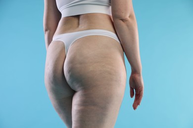 Photo of Woman with cellulite on light blue background, closeup