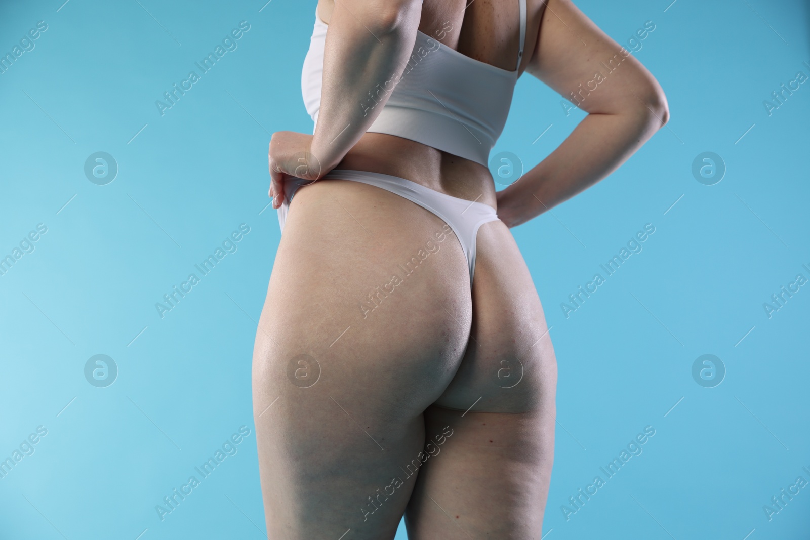 Photo of Woman with cellulite on light blue background, closeup