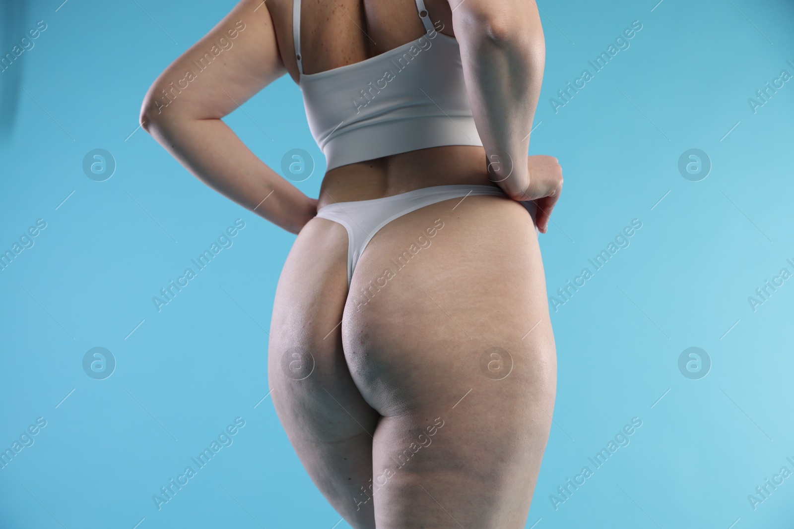 Photo of Woman with cellulite on light blue background, closeup