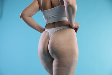 Photo of Woman with cellulite on light blue background, closeup