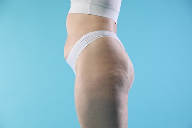 Photo of Woman with cellulite on light blue background, closeup