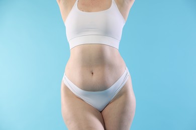 Photo of Woman with cellulite on light blue background, closeup