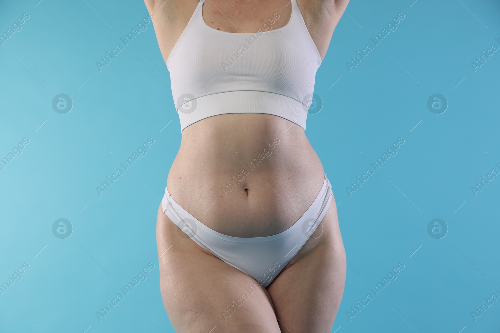 Photo of Woman with cellulite on light blue background, closeup