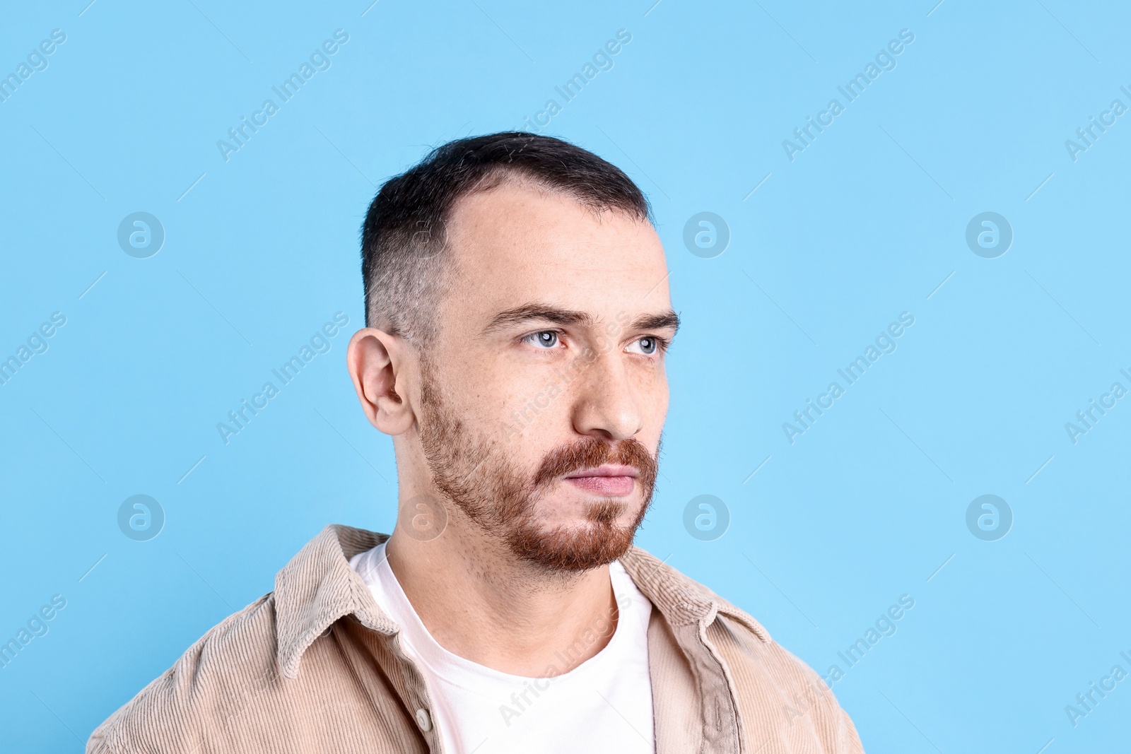 Photo of Baldness problem. Man with receding hairline on light blue background, space for text