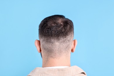 Photo of Baldness problem. Man with bald spot on light blue background, back view