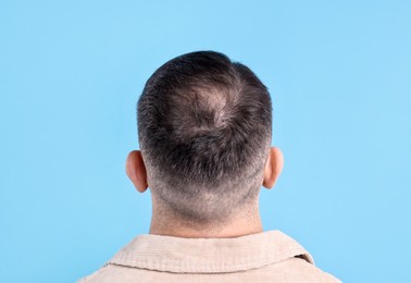 Photo of Baldness problem. Man with bald spot on light blue background, back view